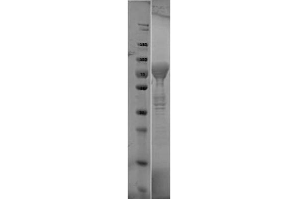 Flagellin Protein (FliC)