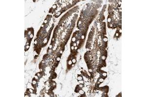 Immunohistochemical staining of human small intestine with MCOLN3 polyclonal antibody  shows strong cytoplasmic positivity at 1:20-1:50 dilution. (Mucolipin 3 Antikörper)