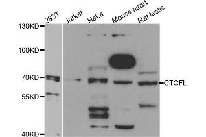 Western blot analysis of extracts of various cell lines, using CTCFL antibody. (CTCFL Antikörper)