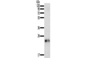 Gel: 12 % SDS-PAGE, Lysate: 50 μg, Lane: Human fetal brain tissue, Primary antibody: ABIN7129442(FAM3A Antibody) at dilution 1/200, Secondary antibody: Goat anti rabbit IgG at 1/8000 dilution, Exposure time: 5 minutes (FAM3A Antikörper)