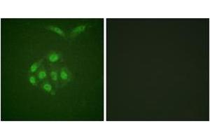 Immunofluorescence analysis of A549 cells, using Survivin (Phospho-Thr117) Antibody. (Survivin Antikörper  (pThr117))