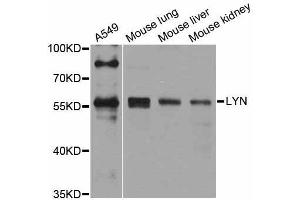 Western blot analysis of extracts of various cell lines, using Lyn antibody (ABIN5998158) at 1/1000 dilution.