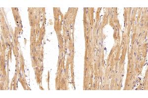 Immunohistochemistry (IHC) image for anti-Gelsolin (GSN) (AA 674-782) antibody (ABIN7442174)