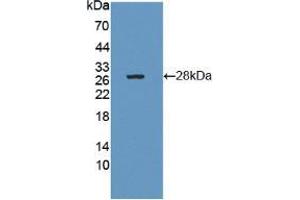 Western blot analysis of recombinant Human CTRB1. (CTRB1 Antikörper  (AA 34-261))