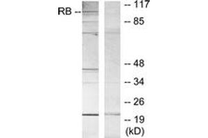 Western blot analysis of extracts from MOLT cells, using Retinoblastoma (Ab-807) Antibody. (Retinoblastoma Protein (Rb) Antikörper  (AA 781-830))