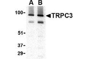 Western blot analysis of TRPC3 in human brain tissue lysate with this product at (A) 1 and (B) 2 μg/ml. (TRPC3 Antikörper  (C-Term))