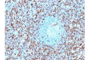 Immunohistochemistry (IHC) image for anti-Annexin A1 (ANXA1) antibody (ABIN6939603)