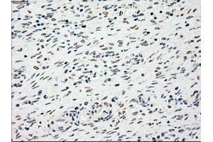 Immunohistochemical staining of paraffin-embedded liver tissue using anti-CHEK2mouse monoclonal antibody. (CHEK2 Antikörper)