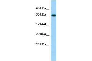 Host: Rabbit Target Name: COL6A5 Sample Type: Fetal Heart lysates Antibody Dilution: 1.
