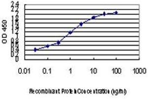 Detection limit for recombinant GST tagged ZIC4 is approximately 0. (ZIC4 Antikörper  (AA 249-319))