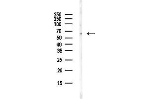 Western blot analysis of lysates from Rat lung, using C Antibody at 1/1000 dilution.