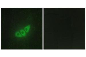 Immunofluorescence (IF) image for anti-Eukaryotic Translation Initiation Factor 2-alpha Kinase 3 (EIF2AK3) (N-Term) antibody (ABIN1850024) (PERK Antikörper  (N-Term))