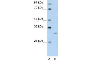 WB Suggested Anti-CREG1 Antibody Titration:  0. (CREG1 Antikörper  (N-Term))