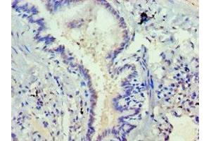 Immunohistochemistry of paraffin-embedded human lung tissue using ABIN7168752 at dilution of 1:100 (DVL2 Antikörper  (AA 1-240))