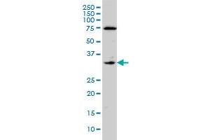 F3 monoclonal antibody (M01A), clone 4G4 Western Blot analysis of F3 expression in A-431 . (Tissue factor Antikörper  (AA 45-154))