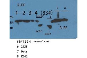 Western Blotting (WB) image for anti-Placental Alkaline Phosphatase (ALPP) (N-Term) antibody (ABIN3187883) (PLAP Antikörper  (N-Term))