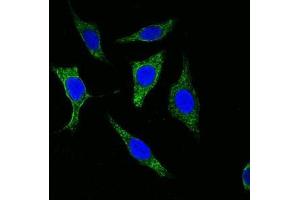 Confocal immunofluorescence analysis of methanol-fixed Eca-109 cells using Cytokeratin (Pan) antibody (green), showing cytoplasmic localization. (pan Keratin Antikörper)