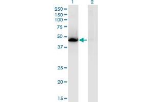 Western Blot analysis of NR1H3 expression in transfected 293T cell line by NR1H3 monoclonal antibody (M08), clone 3E9.