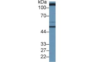 Western Blotting (WB) image for Solute Carrier Family 3 (Activators of Dibasic and Neutral Amino Acid Transport), Member 2 (SLC3A2) ELISA Kit (ABIN6720502)