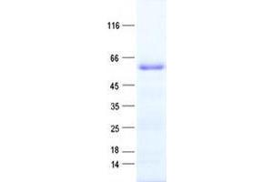 Western Blotting (WB) image for ZINC FINGER PROTEIN 136 (ZNF136) protein (His tag) (ABIN2735923)