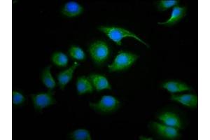 Immunofluorescence staining of A549 cells with ABIN7170898 at 1:100, counter-stained with DAPI. (Sdhaf2 Antikörper  (AA 30-166))