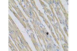 Immunohistochemistry of paraffin-embedded Rat heart using PRNP Polyclonal Antibody at dilution of 1:100 (40x lens). (PRNP Antikörper)