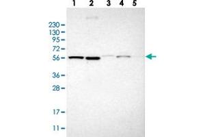 Western blot analysis of Lane 1: RT-4, Lane 2: U-251 MG, Lane 3: Human Plasma, Lane 4: Liver, Lane 5: Tonsil with TMEM194A polyclonal antibody  at 1:250-1:500 dilution. (TMEM194A Antikörper)