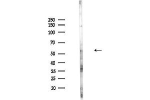 Western blot analysis of lysates from Hela cells(heat-shock,45 min treatment), using Phospho-CDC25A (Ser178) Antibody at 1/1000 dilution.