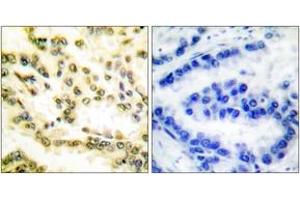 Immunohistochemistry (IHC) image for anti-Lamin A/C (LMNA) (AA 181-230), (Cleaved-Asp230) antibody (ABIN1536092)