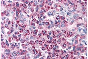 Human Pancreas: Formalin-Fixed, Paraffin-Embedded (FFPE) (TLR3 Antikörper  (AA 514-657))