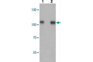 Western blot analysis of TRIM24 in EL4 cell lysate with TRIM24 polyclonal antibody  at (lane 1) 0. (TRIM24 Antikörper  (Internal Region))