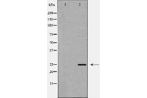Western blot analysis of CHOP expression in Jurkat cell lysate,The lane on the left is treated with the antigen-specific peptide. (DDIT3 Antikörper  (Internal Region))