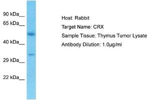 Host: Rabbit Target Name: CRX Sample Type: Thymus Tumor lysates Antibody Dilution: 1. (CRX Antikörper  (N-Term))
