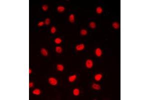 Immunofluorescent analysis of CREB staining in MCF7 cells. (CREB1 Antikörper  (Center))
