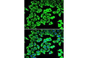 Immunofluorescence analysis of U20S cell using RPLP2 antibody. (RPLP2 Antikörper)