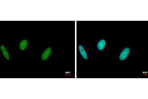 ICC/IF Image RAD18 antibody [N1C1] detects RAD18 protein at nucleus by immunofluorescent analysis. (RAD18 Antikörper  (Center))