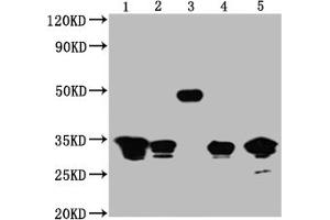 Western Blot Positive WB detected in: 1,2,3 and 4 are Recombinant proteins with GFP tag for 50 ng, 5, 293F whole cell lysate transfected with GFP for 5 μg All lanes GFP antibody at 1:5000 Secondary Goat polyclonal to mouse IgG at 1/50000 dilution Predicted band size:1,2,3,4 and 5 is 32,32,50,32,32 KDa respectively Observed band size: 32,32,50,32,32 KDa Exposure time:1 min (GFP Antikörper)