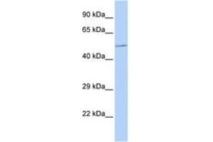 Image no. 1 for anti-UDP-Gal:betaGlcNAc beta 1,4- Galactosyltransferase, Polypeptide 3 (B4GALT3) (AA 288-337) antibody (ABIN6743374)