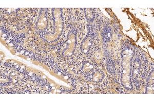 Immunohistochemistry (IHC) image for anti-Procollagen III N-Terminal Propeptide (PIIINP) antibody (ABIN7427888)