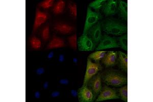 ABIN6259163 and ABIN6274159 staining  cells by IF/ICC. (TACSTD2 Antikörper  (Internal Region))