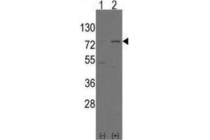 Western blot analysis of Nrf2(Nfe2l2)(arrow) using rabbit polyclonal Nrf2(Nfe2l2) Antibody (N-term) . (NRF2 Antikörper  (N-Term))