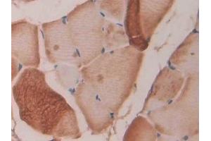 Detection of FBN1 in Rat Skeletal muscle Tissue using Polyclonal Antibody to Fibrillin 1 (FBN1) (Fibrillin 1 Antikörper  (AA 751-895))