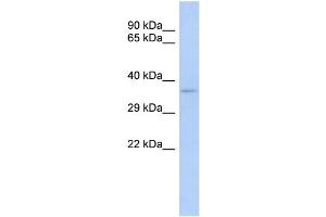 WB Suggested Anti-TRADD Antibody Titration:  0. (TRADD Antikörper  (Middle Region))