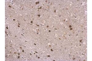 Immunohistochemistry (IHC) image for anti-Neuronal PAS Domain Protein 1 (NPAS1) antibody (ABIN2856208)