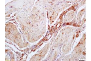 Formalin-fixed and paraffin embedded mouse stomach labeled with Anti-Phospho-MYPT1(Thr696) Polyclonal Antibody, Unconjugated (ABIN744068) at 1:200 followed by conjugation to the secondary antibody and DAB staining (PPP1R12A Antikörper  (pThr696))