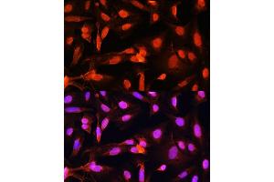 Immunofluorescence analysis of U20S cells using SGOL1 antibody (ABIN7270288) at dilution of 1:100. (Shugoshin Antikörper  (AA 10-100))