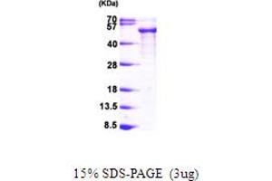 SDS-PAGE (SDS) image for tau Protein (AA 1-352) protein (His tag) (ABIN667803)
