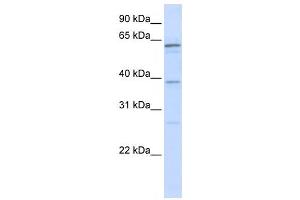 Western Blotting (WB) image for anti-RNA Binding Motif Protein 39 (RBM39) antibody (ABIN2458513)