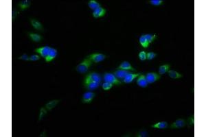 Immunofluorescence staining of Hela cells with ABIN7152472 at 1:100, counter-stained with DAPI. (FBXL2 Antikörper  (AA 1-423))