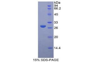SDS-PAGE (SDS) image for Lysyl Oxidase-Like 3 (LOXL3) (AA 509-712) protein (His tag) (ABIN2125760) (LOXL3 Protein (AA 509-712) (His tag))